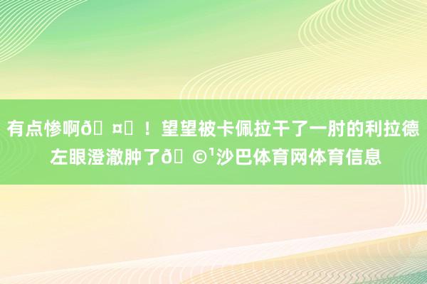 有点惨啊🤕！望望被卡佩拉干了一肘的利拉德 左眼澄澈肿了🩹沙巴体育网体育信息